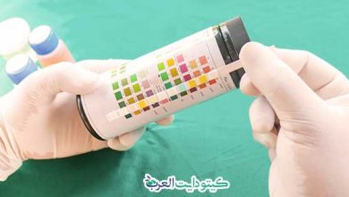 شرائط الكيتو دايت