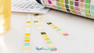 لون البول في الكيتو دايت -01